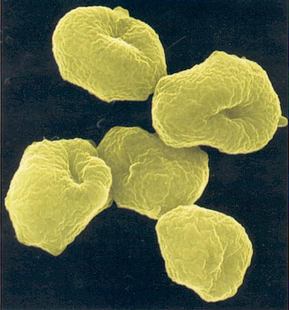 Sulfolobus Archaea