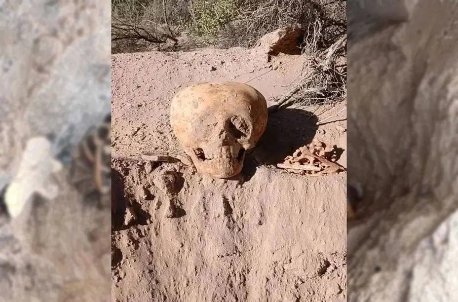 Crâne allongé en Argentine, il y a 800 à 1800 ans.