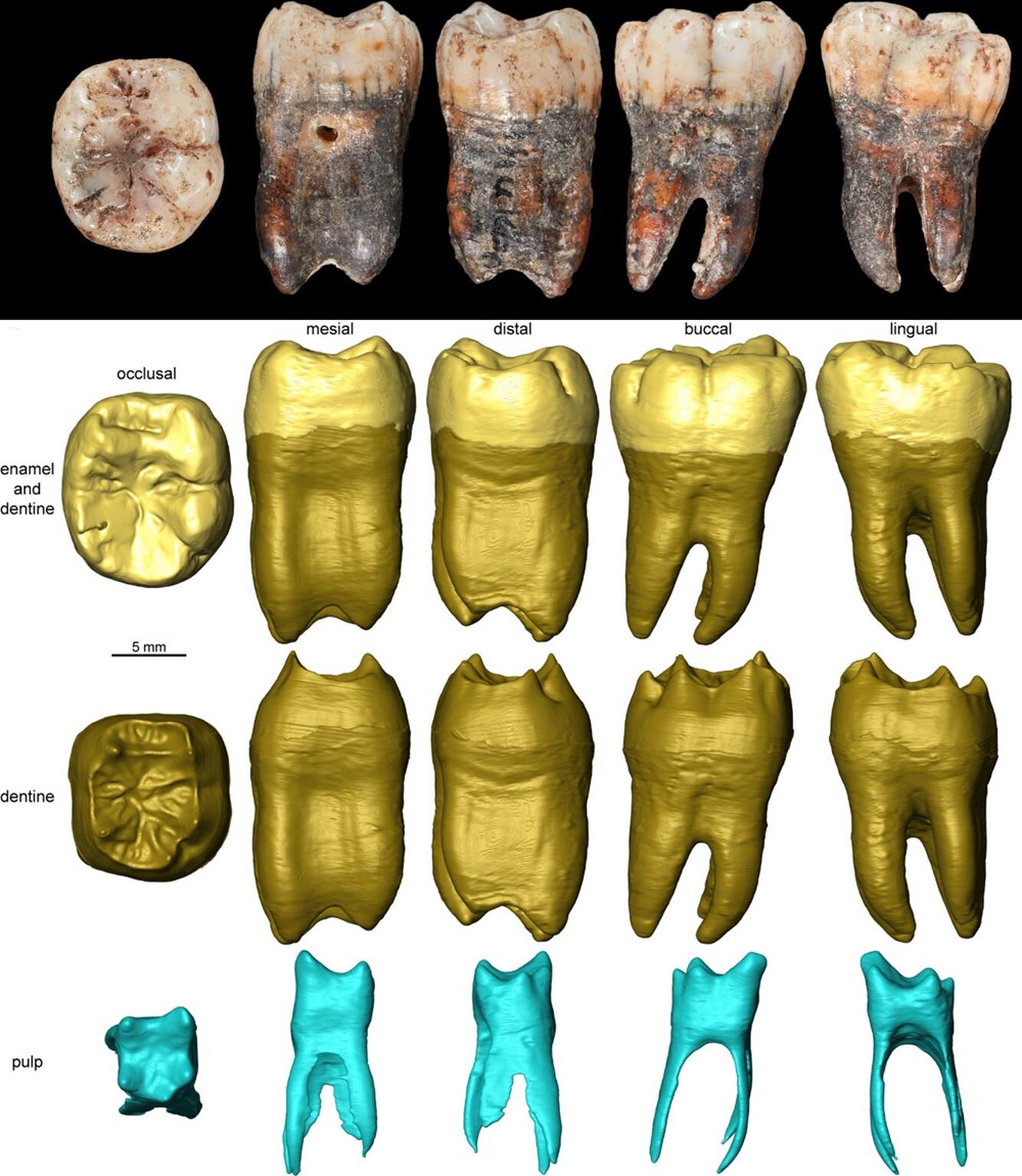Dent de l'enfant de 9 ans, grotte de Shuqba en Jordanie.