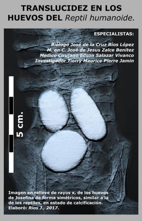 Entité Josefina enceinte de trois œufs, reptile humanoïde, radiographie par Edson Salazar Vivanco.