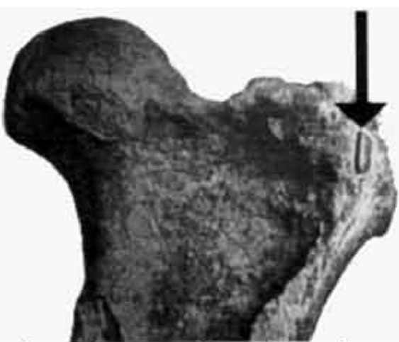 Projectile en quartzite planté dans le fémur d'un toxodonte en Argentine, il y a 3 à 2 millions d'années.