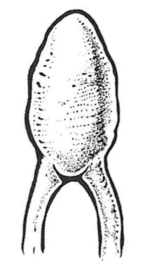 Pomme de pin