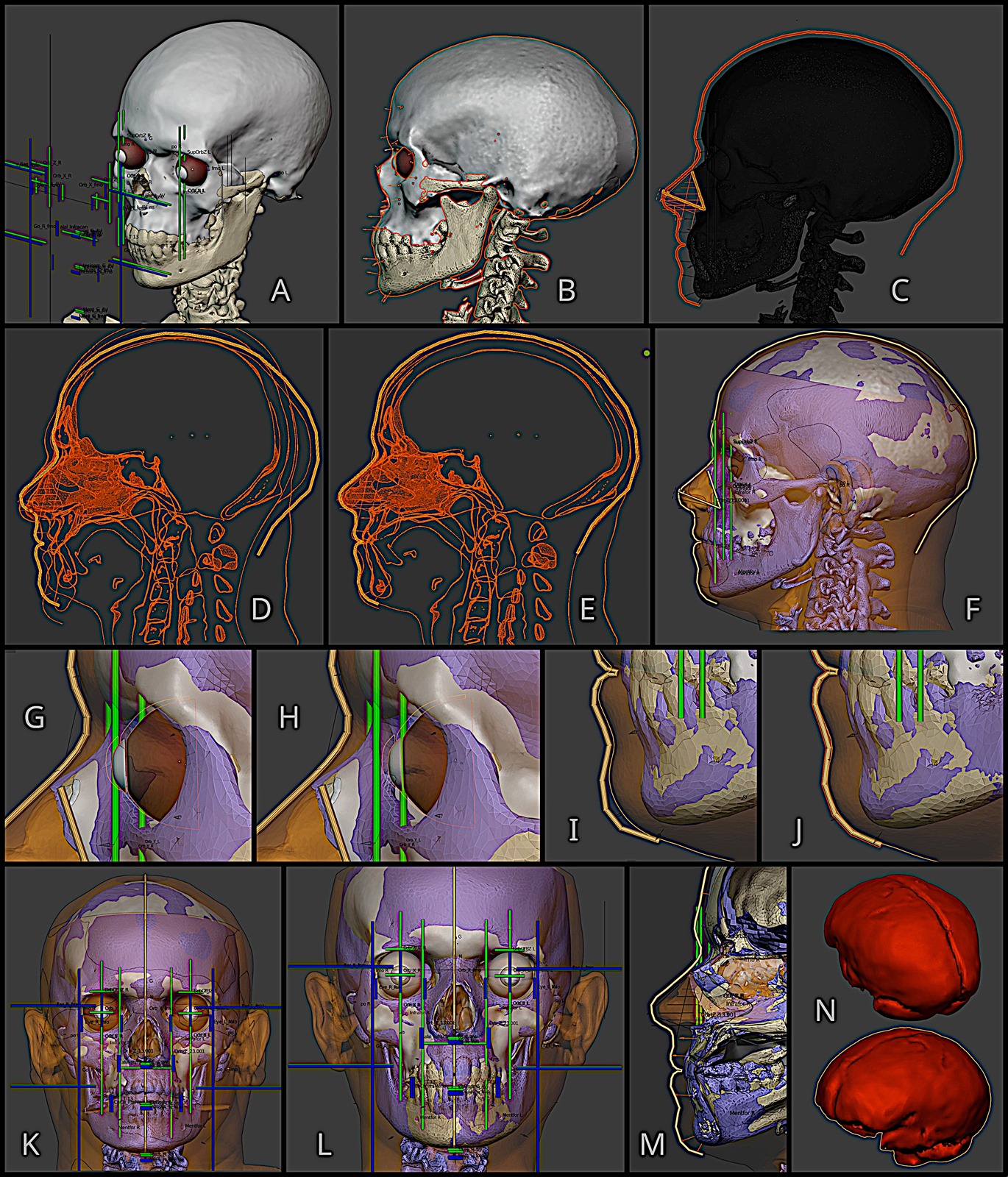 Approximation faciale médico-légale et de la déformation anatomique d'Homo Mladec 1
