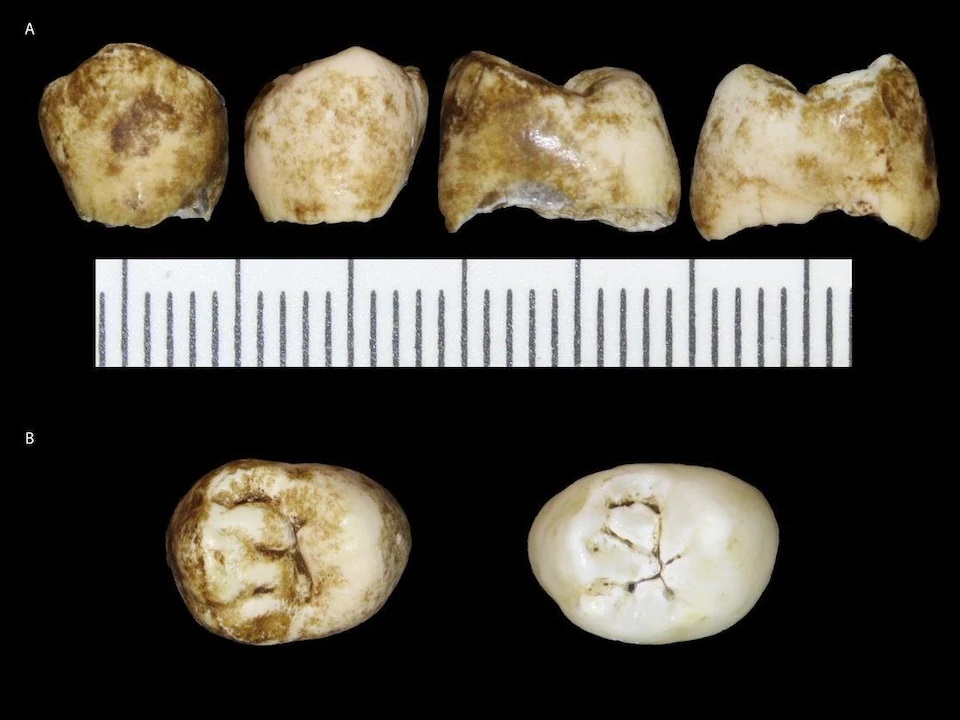 Six dents d'Homo naledi