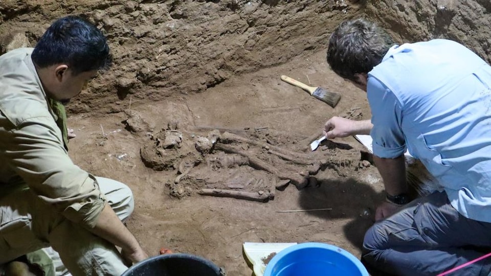 Amputation chirurgicale de la jambe gauche sur un homo sapiens, il y a 31 000 ans.