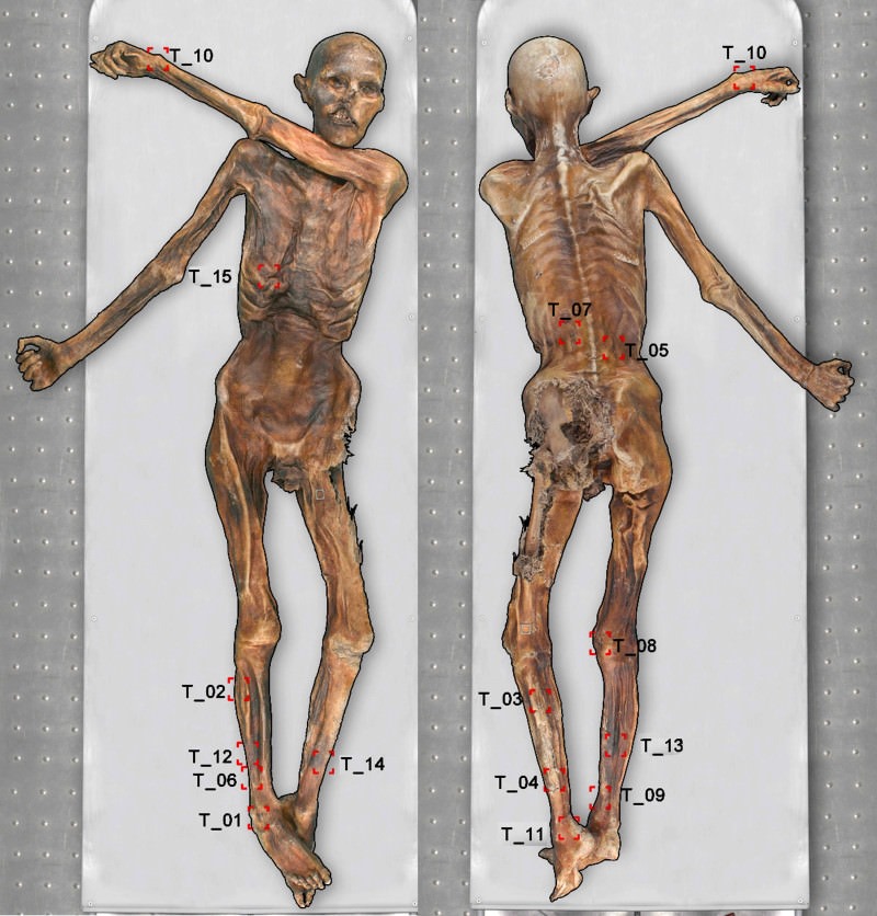 Ötzi