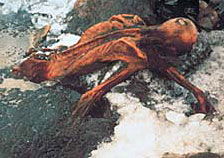 Ötzi