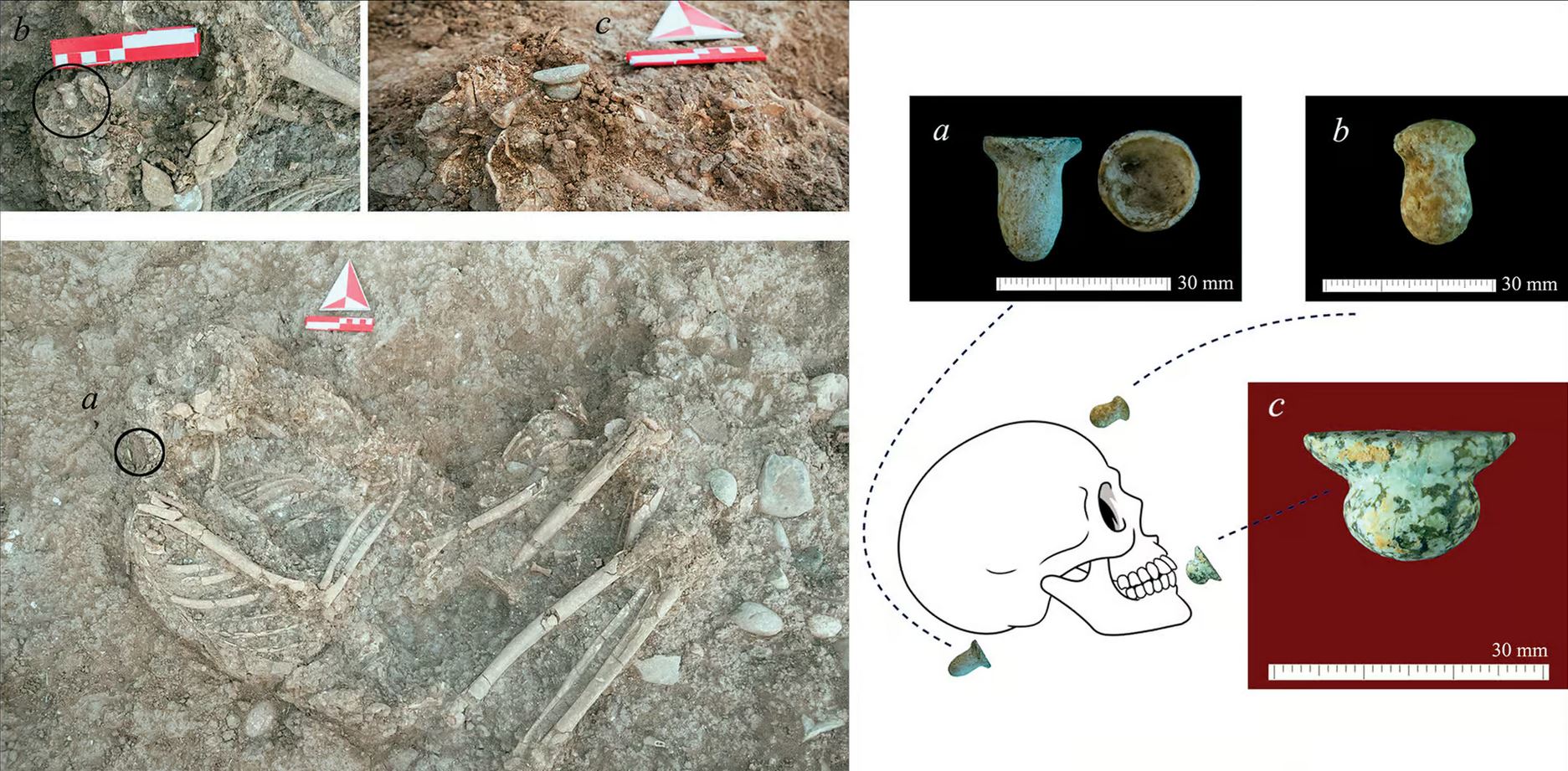 Piercings aux oreilles & lèvres inférieures à Boncuklu Tarla en Turquie, il y a 11 000 ans.